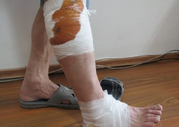 Кучета нахапаха жестоко 69-годишен мъж