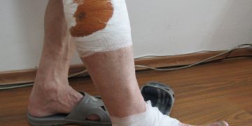 Кучета нахапаха жестоко 69-годишен мъж