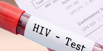 Проверете безплатно и анонимно своя ХИВ статус в РЗИ – Габрово
