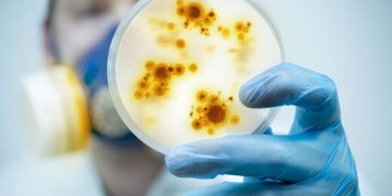 Клуб “Здрав живот и холистично здраве” представя следващата актуална тема –  инфекцията