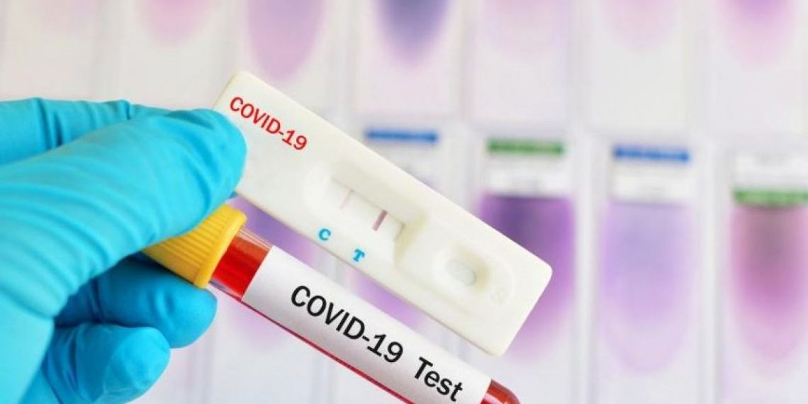 Половината от учителите от общината поискаха антигенни тестове