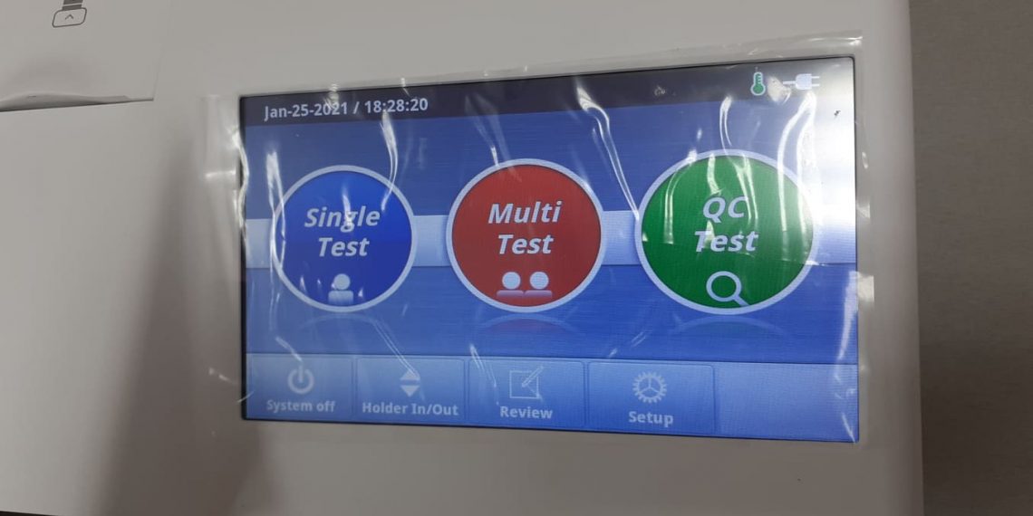 Тест за количеството антитела след COVID-19