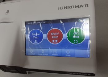 Тест за количеството антитела след COVID-19