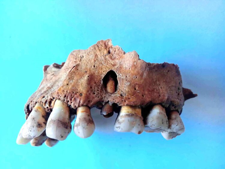 Зъбна инфекция на 750 г. бе открита в средновековен Хоталич