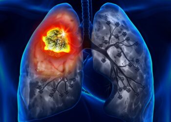 От 17-ти – безплатни прегледи за туберкулоза в “ДКЦ-1-Севлиево” ЕООД и Парахода в Габрово