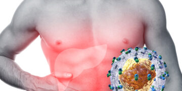 „Време е за действие“ – Световен ден за борба с хепатита – 29.07 – 02.08.2024 г.