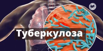 От понеделник – седмица на отворените врати за ранно откриване на туберкулоза в област Габрово